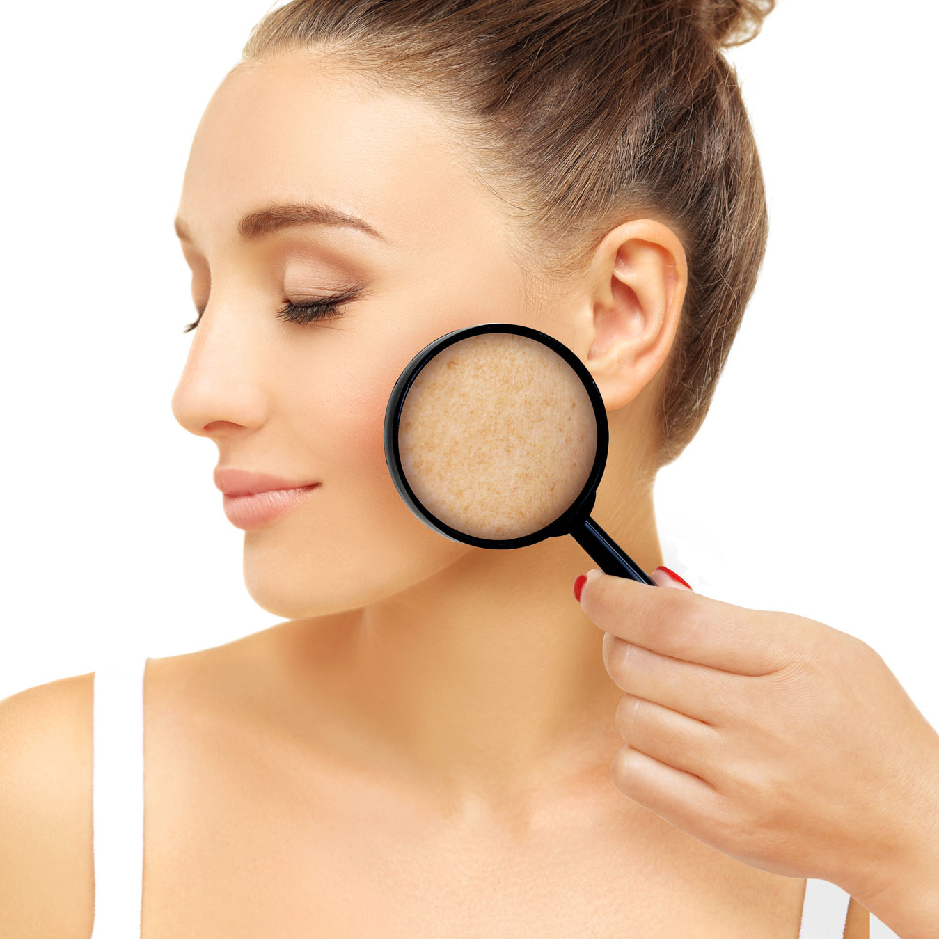 Hyperpigmentation